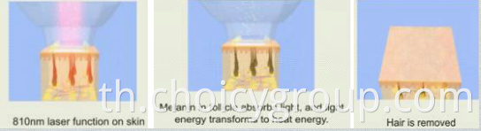 Diode laser Working theory